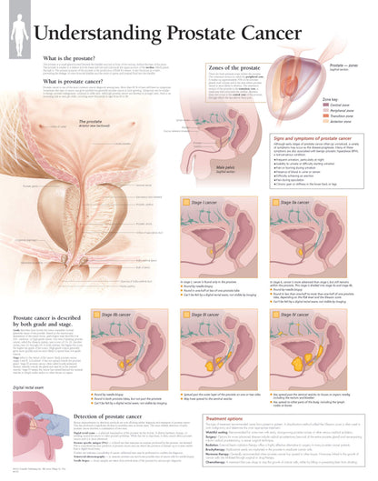 Understanding Prostate Cancer 4501