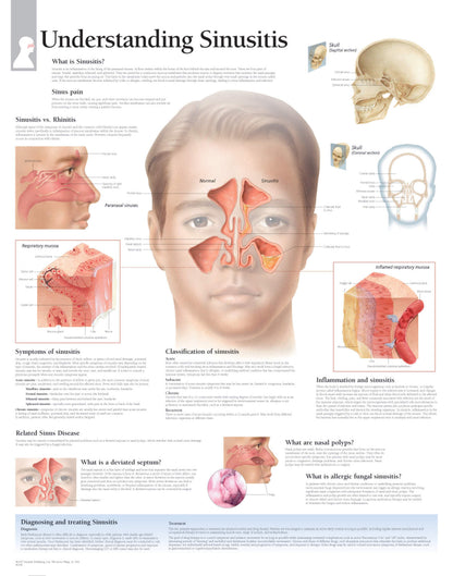 Understanding Sinusitis  1358