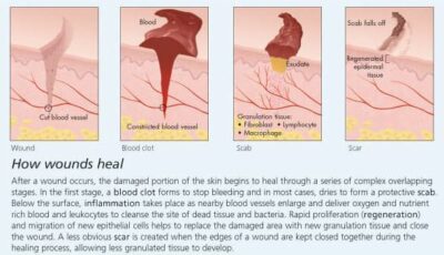 Understanding Skin 2500 2