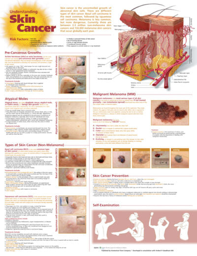 Understanding Skin Cancer Anatomical Chart 9998 1