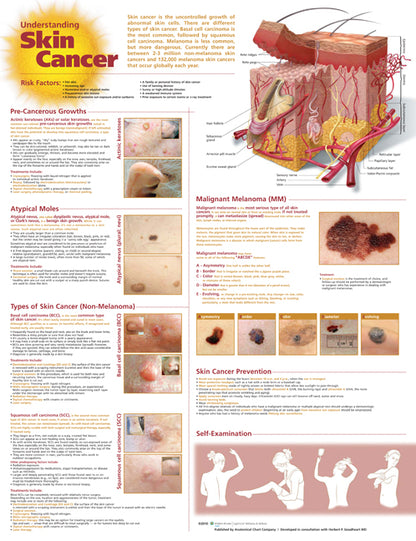 Understanding Skin Cancer Anatomical Chart 9998