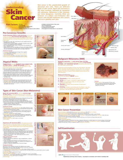 Understanding Skin Cancer Anatomical Chart 9998