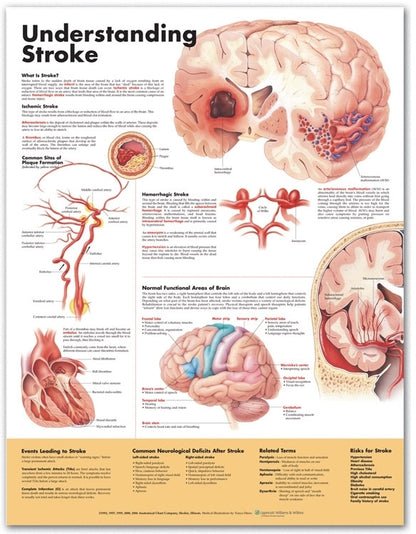 Understanding Stroke Anatomical Chart 9868