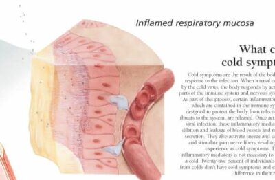 Understanding the Common Cold 1354 3