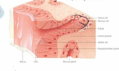 Understanding the Common Cold 1354 2