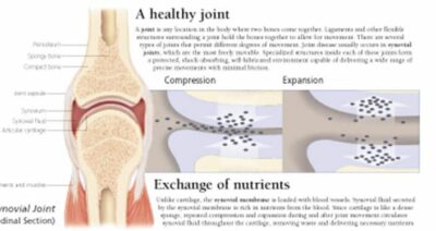 Understanding the Hip & Knee 1002 3