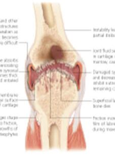 Understanding the Hip & Knee 1002 2