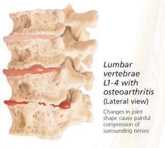 Understanding the Spine 1051 2