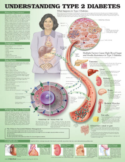 Understanding Type 2 Diabetes Anatomical Chart 9753 1