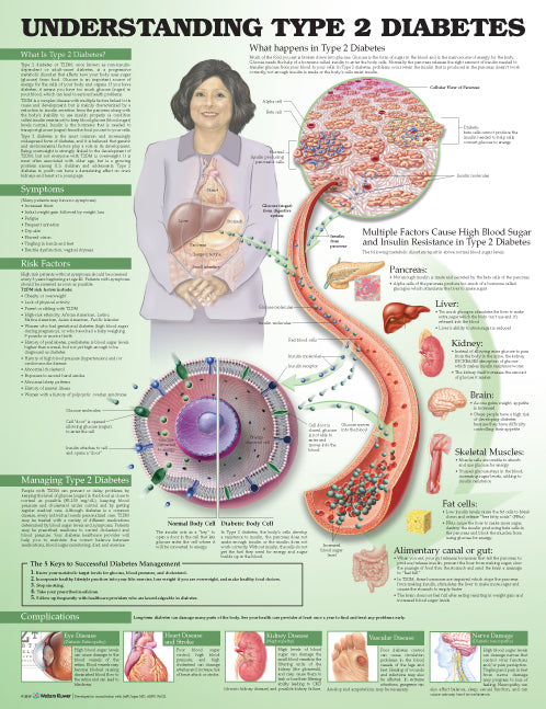 Understanding Type 2 Diabetes Anatomical Chart 9753