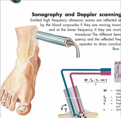 Varicose Veins Chart VR1367 1