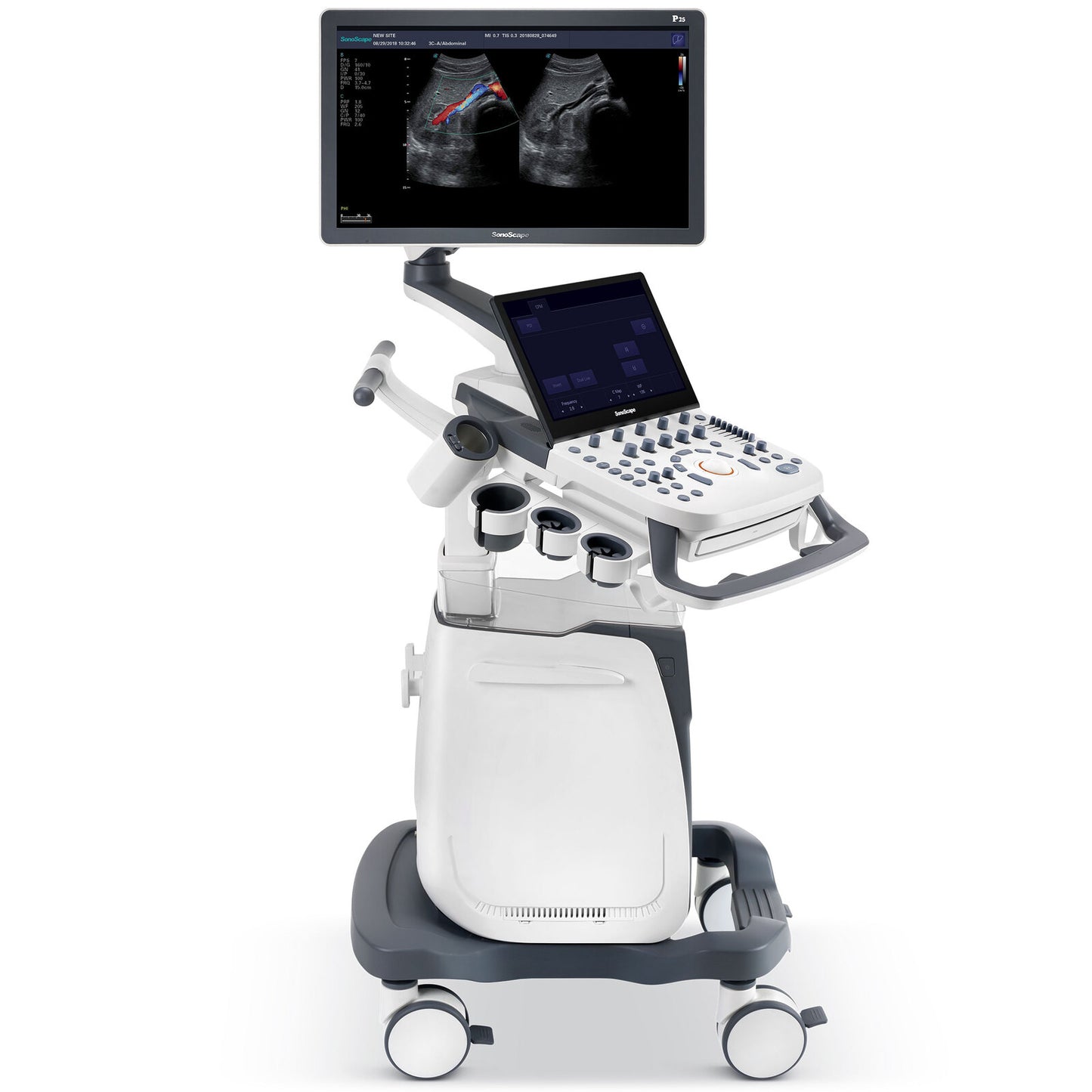 Ultrasound Machine P25