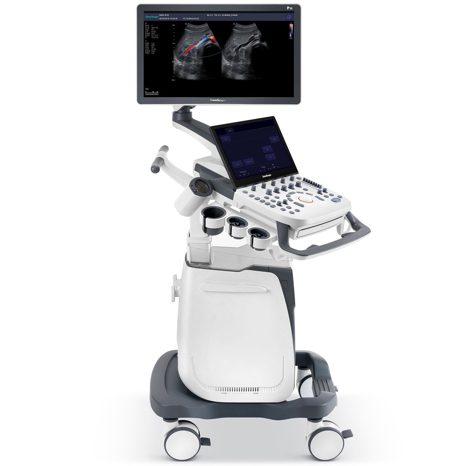 Ultrasound Machine P25