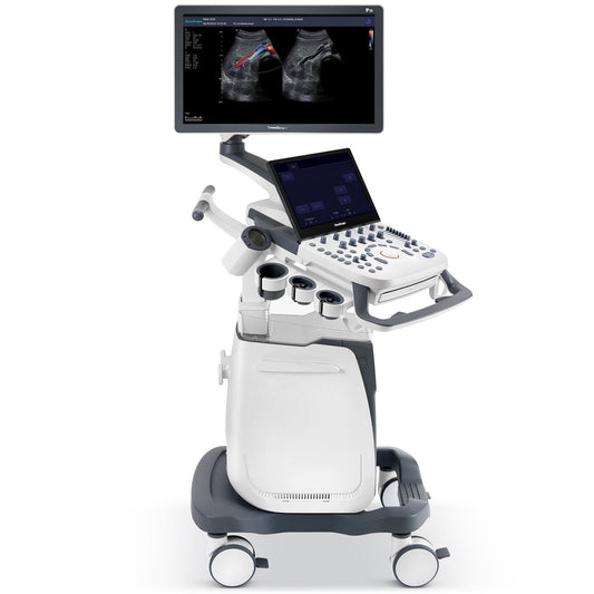 Ultrasound Machine P25