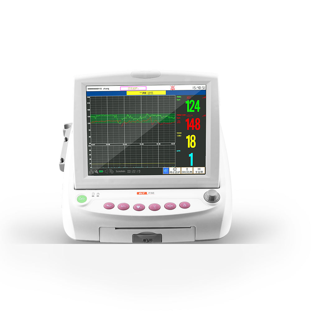 Fetal Monitor F80