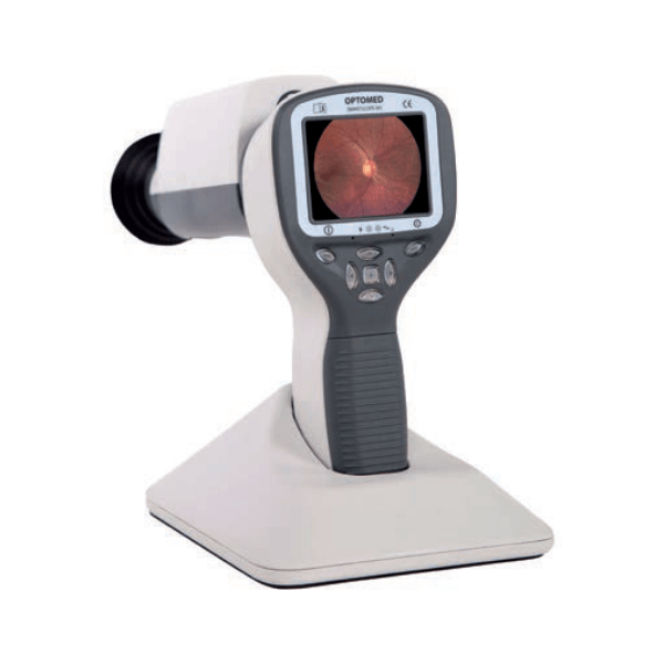 Optomed-Smartscope-Pro-01